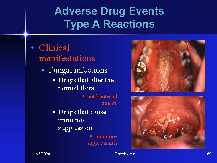 Adverse Drug Events Type A Reactions • Clinical manifestations • Fungal infections • Drugs
