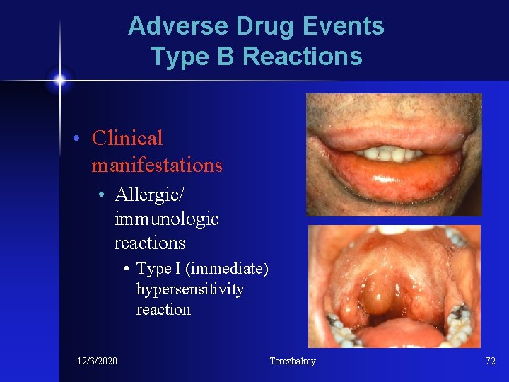 Adverse Drug Events Type B Reactions • Clinical manifestations • Allergic/ immunologic reactions •