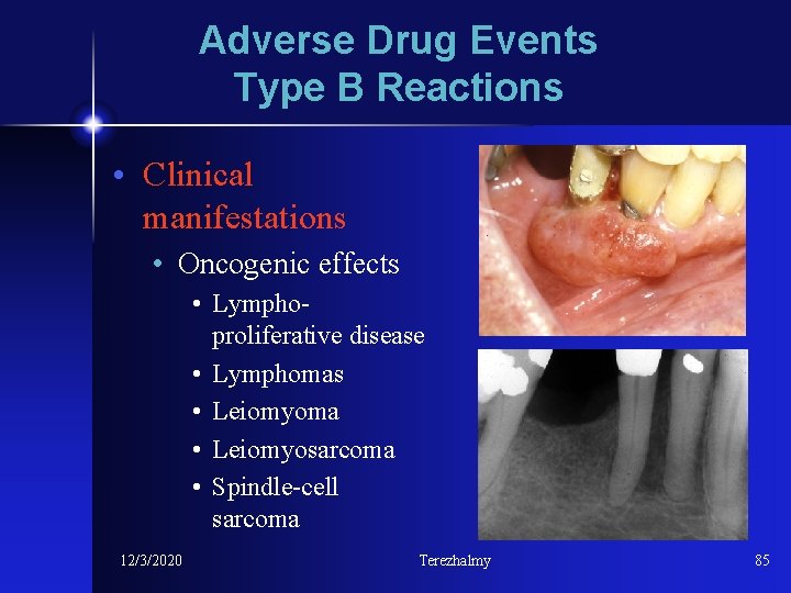 Adverse Drug Events Type B Reactions • Clinical manifestations • Oncogenic effects • Lymphoproliferative