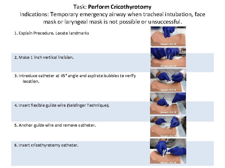 Task: Perform Cricothyrotomy Indications: Temporary emergency airway when tracheal intubation, face mask or laryngeal