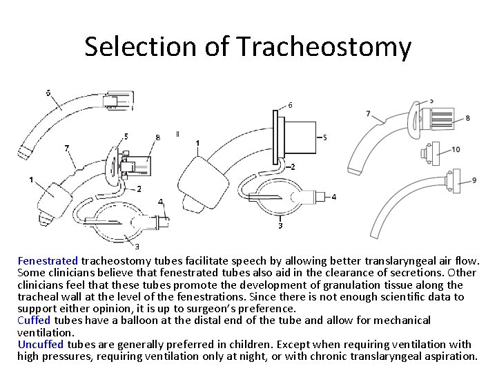 Selection of Tracheostomy Fenestrated tracheostomy tubes facilitate speech by allowing better translaryngeal air flow.