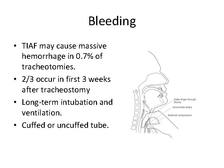 Bleeding • TIAF may cause massive hemorrhage in 0. 7% of tracheotomies. • 2/3