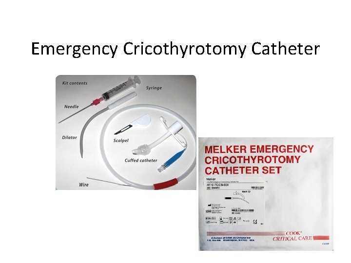 Emergency Cricothyrotomy Catheter 
