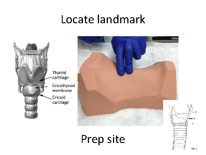 Locate landmark Prep site 