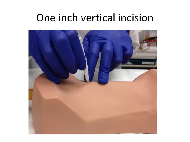 One inch vertical incision 