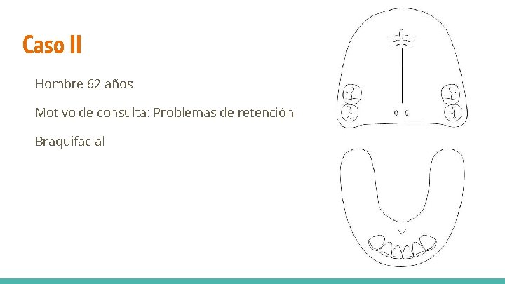 Caso II Hombre 62 años Motivo de consulta: Problemas de retención Braquifacial 