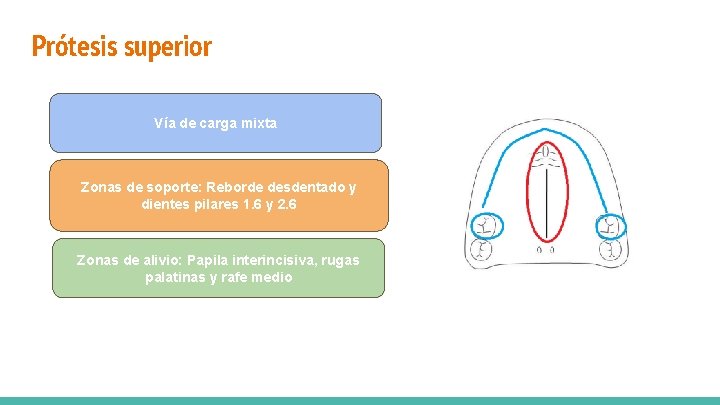 Prótesis superior Vía de carga mixta Zonas de soporte: Reborde desdentado y dientes pilares