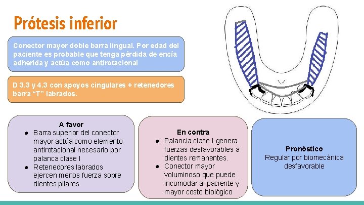 Prótesis inferior soporte: Reborde desdentado y dientes pilares 1. 6 y 2. 6 Conector