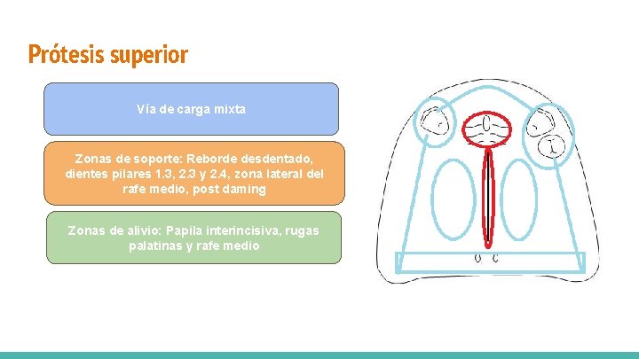 Prótesis superior Vía de carga mixta Zonas de soporte: Reborde desdentado, dientes pilares 1.