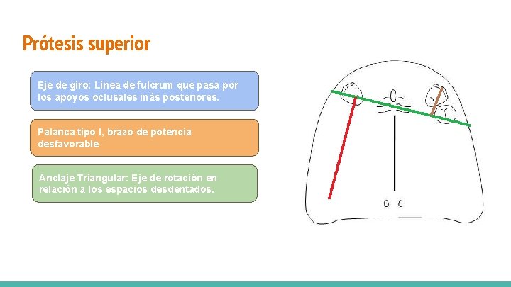 Prótesis superior Eje de giro: Línea de fulcrum que pasa por los apoyos oclusales