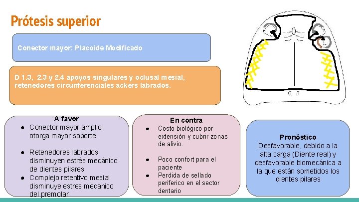 Prótesis superior Vía de carga mixta Conector mayor: Placoide Modificado D 1. 3, 2.
