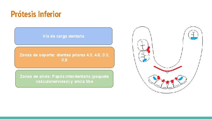 Prótesis Inferior Vía de carga dentaria Zonas de soporte: dientes pilares 4. 3, 4.