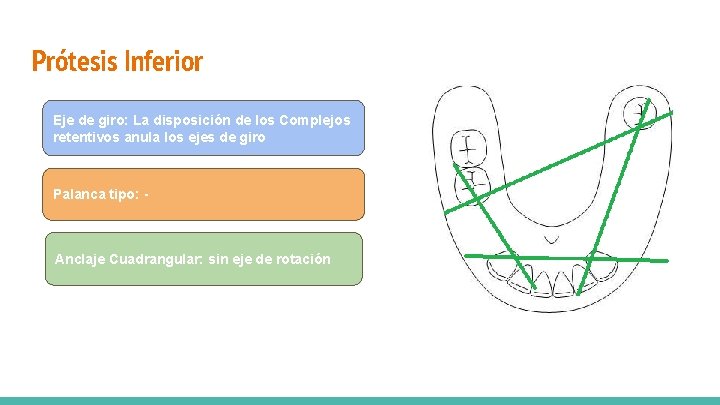 Prótesis Inferior Eje de giro: La disposición de los Complejos retentivos anula los ejes