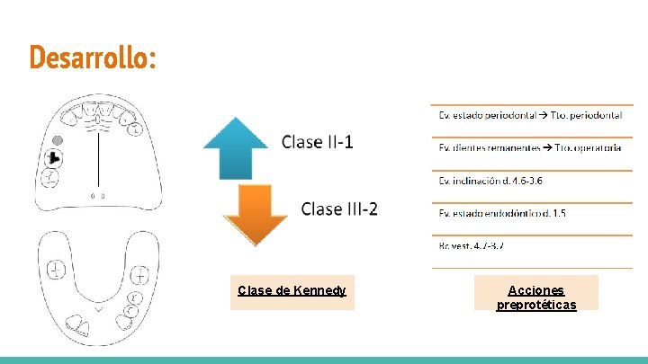 Desarrollo: Clase de Kennedy Acciones preprotéticas 