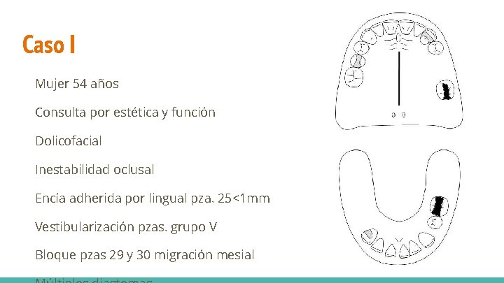 Caso I Mujer 54 años Consulta por estética y función Dolicofacial Inestabilidad oclusal Encía