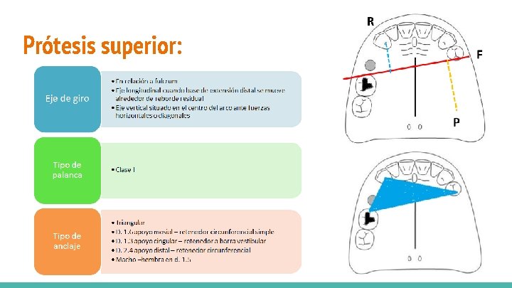 Prótesis superior: 