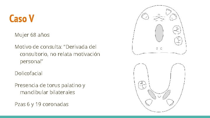 Caso V Mujer 68 años Motivo de consulta: “Derivada del consultorio, no relata motivación
