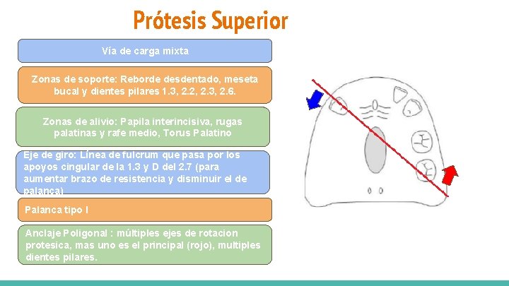 Prótesis Superior Vía de carga mixta Zonas de soporte: Reborde desdentado, meseta bucal y