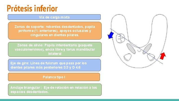 Prótesis inferior Vía de carga mixta Zonas de soporte: Reborde desdentado y dientes pilares