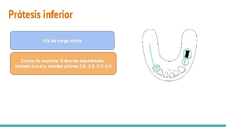 Prótesis inferior Zonas de soporte: Reborde desdentado y dientes pilares 1. 6 y 2.