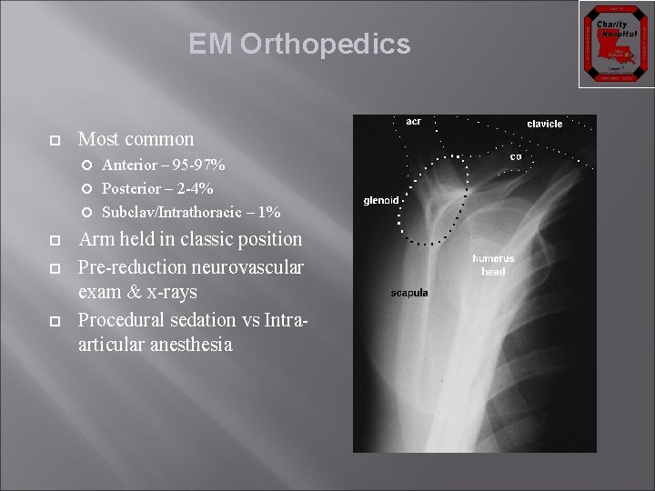 EM Orthopedics Most common Anterior – 95 -97% Posterior – 2 -4% Subclav/Intrathoracic –