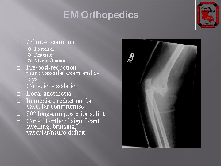 EM Orthopedics 2 nd most common Posterior Anterior Medial/Lateral Pre/post-reduction neurovascular exam and xrays