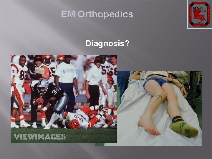 EM Orthopedics Diagnosis? 