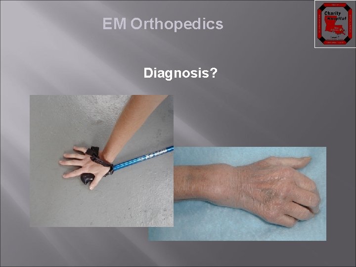 EM Orthopedics Diagnosis? 