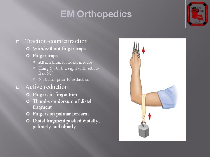 EM Orthopedics Traction-countertraction With/without finger traps Finger traps Attach thumb, index, middle Hang 5