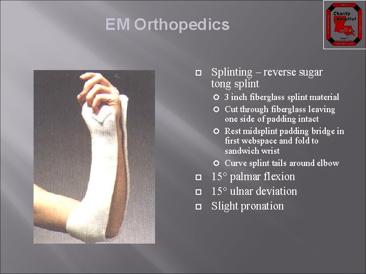 EM Orthopedics Splinting – reverse sugar tong splint 3 inch fiberglass splint material Cut