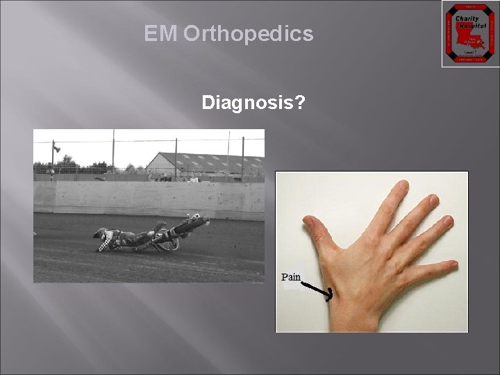 EM Orthopedics Diagnosis? 