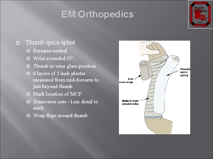 EM Orthopedics Thumb spica splint Forearm neutral Wrist extended 25° Thumb in wine glass