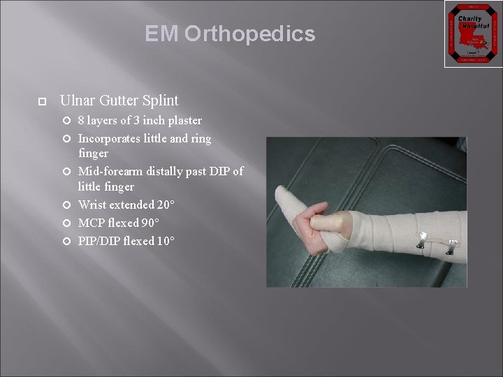 EM Orthopedics Ulnar Gutter Splint 8 layers of 3 inch plaster Incorporates little and