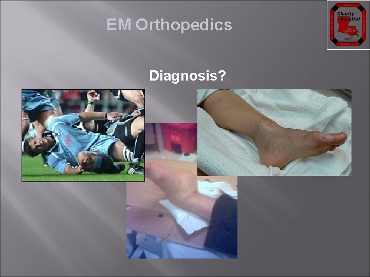 EM Orthopedics Diagnosis? 