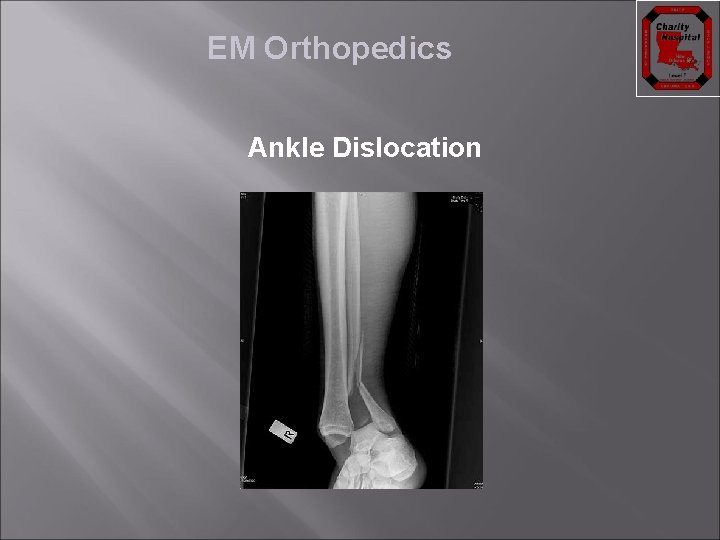 EM Orthopedics Ankle Dislocation 