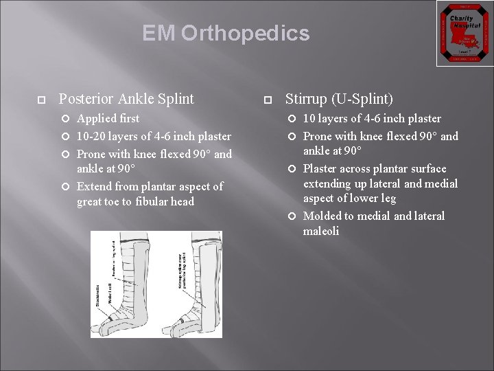 EM Orthopedics Posterior Ankle Splint Applied first 10 -20 layers of 4 -6 inch