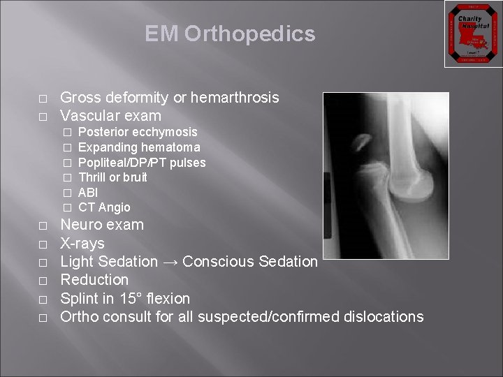 EM Orthopedics � � Gross deformity or hemarthrosis Vascular exam � � � Posterior