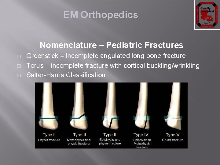 EM Orthopedics Nomenclature – Pediatric Fractures � � � Greenstick – incomplete angulated long