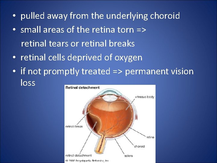  • pulled away from the underlying choroid • small areas of the retina