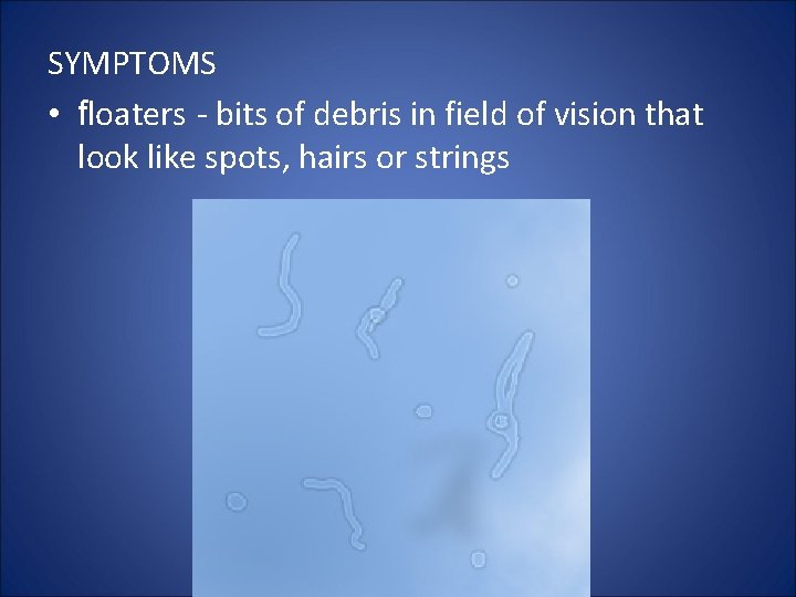 SYMPTOMS • floaters - bits of debris in field of vision that look like