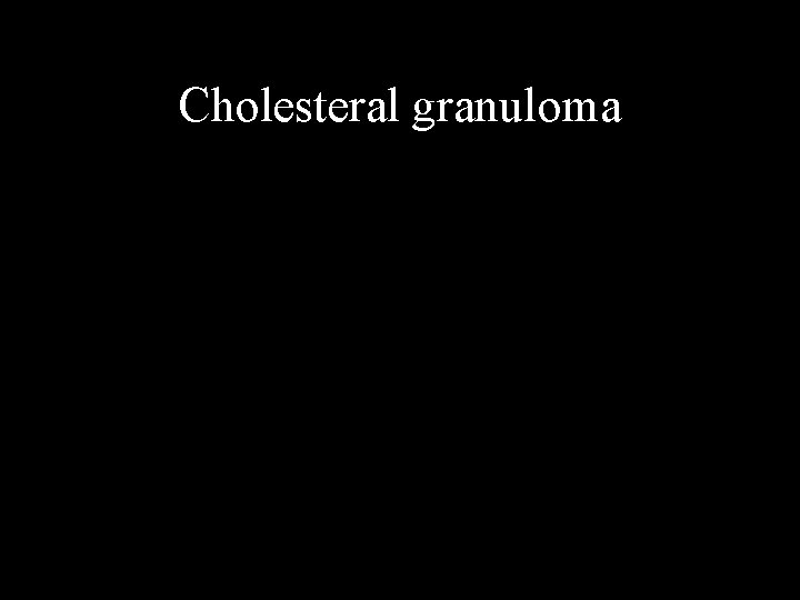 Cholesteral granuloma 