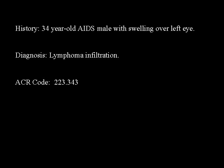 History: 34 year-old AIDS male with swelling over left eye. Diagnosis: Lymphoma infiltration. ACR