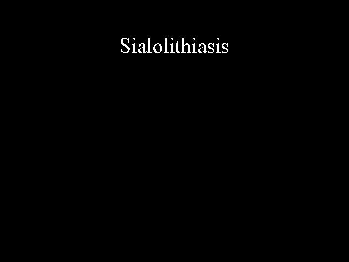 Sialolithiasis 