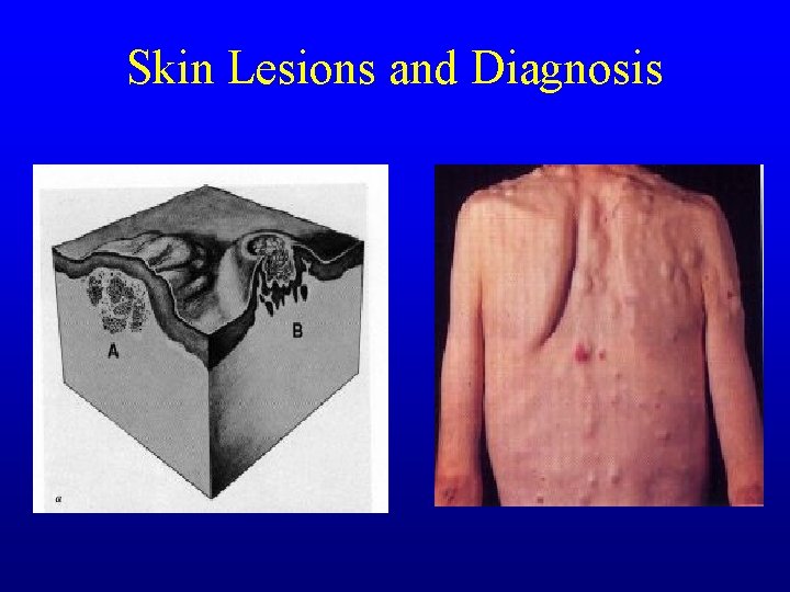 Skin Lesions and Diagnosis Skin Lesions and Diagnosis