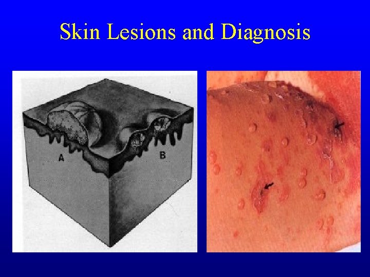 Skin Lesions and Diagnosis Skin Lesions and Diagnosis