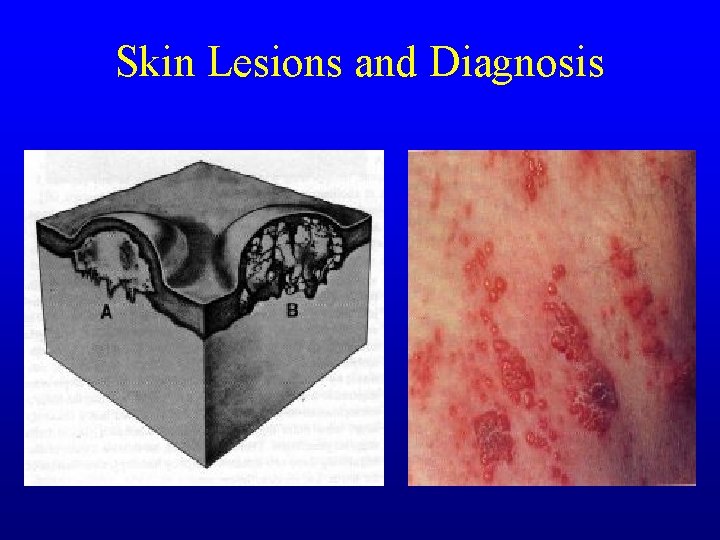 Skin Lesions and Diagnosis Skin Lesions and Diagnosis