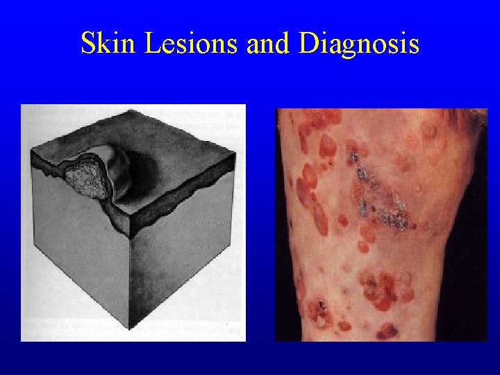 Skin Lesions and Diagnosis Skin Lesions and Diagnosis