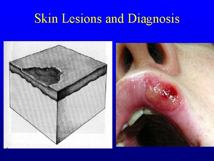 Skin Lesions and Diagnosis Skin Lesions and Diagnosis