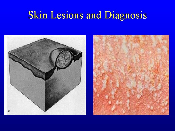 Skin Lesions and Diagnosis Skin Lesions and Diagnosis