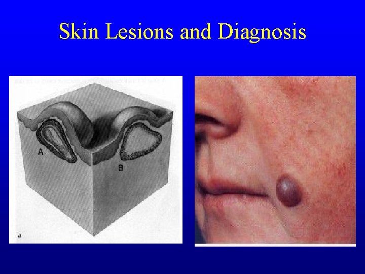 Skin Lesions and Diagnosis Skin Lesions and Diagnosis
